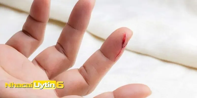 Giấc mơ thấy ngón tay có ý nghĩa gì?